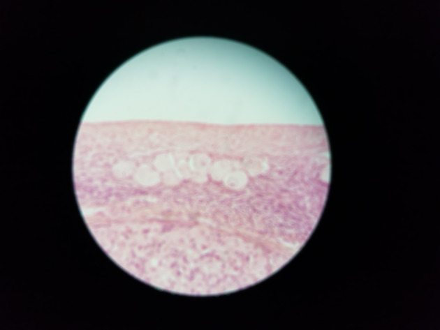 Ovary Slides - Ovary 007 400X